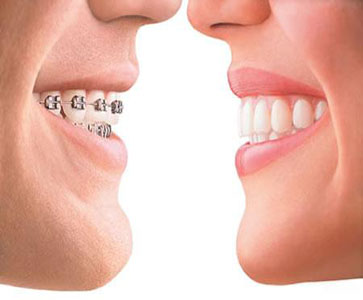 Orthodontics Image